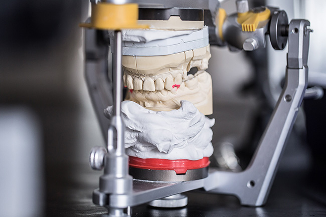 Zahnarzt in Schwabing für Zahnersatz