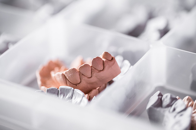 Das Implantat als künstliche Zahnwurzel